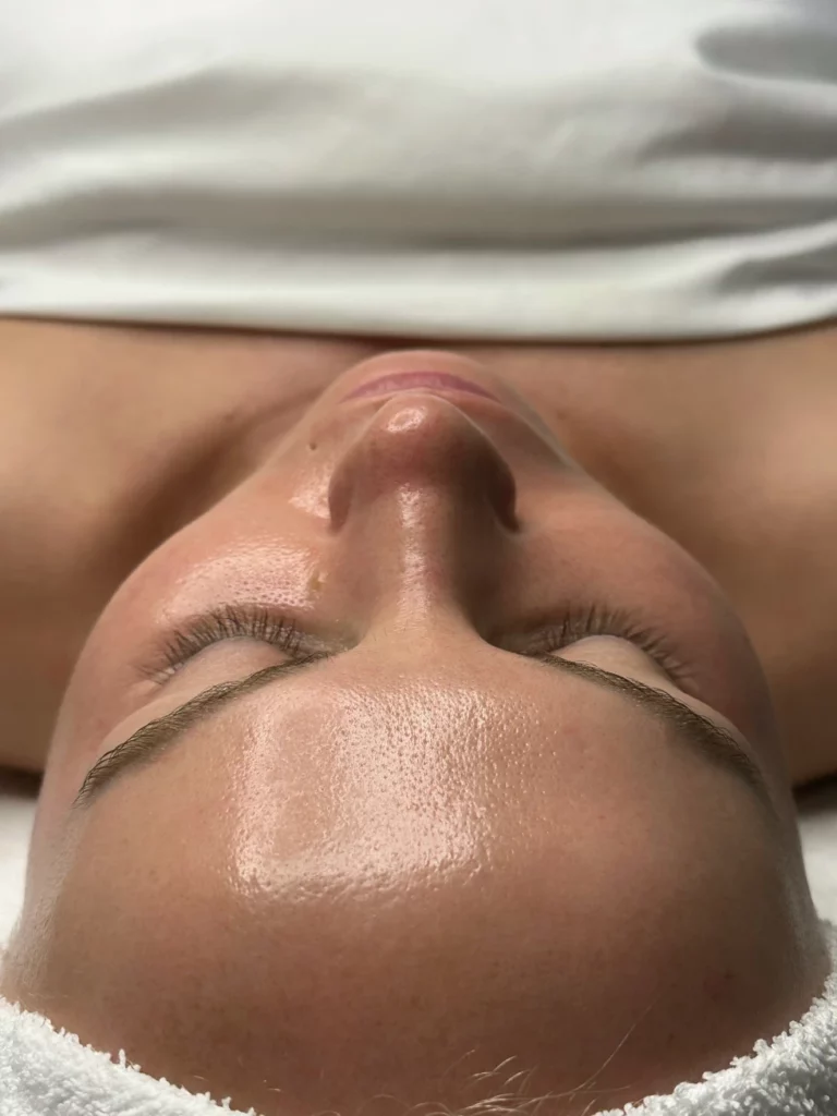 Skin Care Facial Peels Lawa Salon